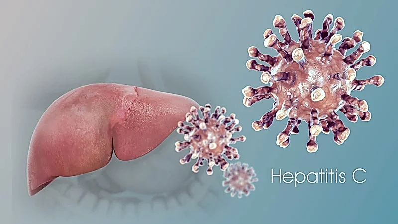 Ozon ile Hepatit Hastalığı Tedavisi