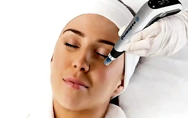 Cilt Gençleştirmede Mikroneedling (Dermapen)