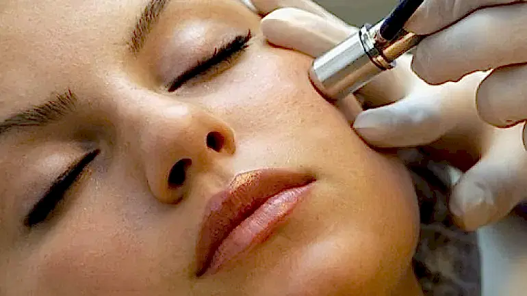 Cilt Gençleştirmede Ozon Tedavisi