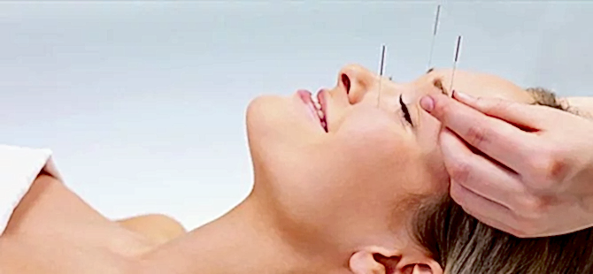 Kozmetik Akupunktur Nerelerde Kullanılır?